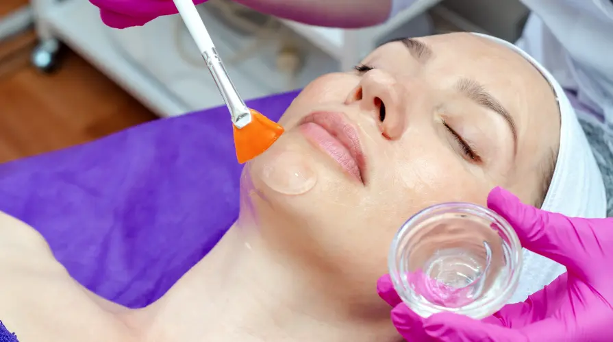 Chemical skin peel treatment London Essex Aesthetics